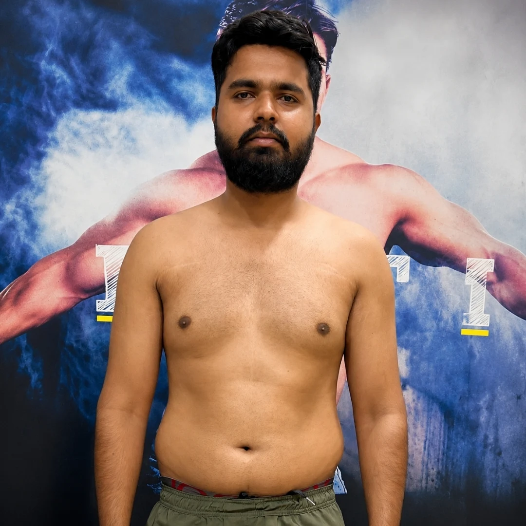 Yogesh  Before